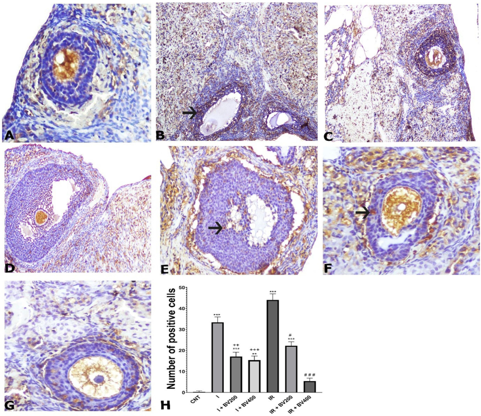 TUNEL staining photomicrographs of all experimental groups. A) CNT, 10X; B) I, 10X; C) I + BV200, 10X; D) I + BV400, 20X; E) IR, 20X; F) IR + BV200, 20X; G) IR + BV400, 20X; arrows signify apoptotic cells. H) Numbers of positive cells as seen by TUNEL staining. *: Compared to CNT; +: comparing I + BV groups with I; #: comparing IR + BV groups with IR. CNT: Control; I: ischemia, IR: ischemia + reperfusion; *, +, #: p<0.05; **, ++, ##: p<0.01; ***, +++, ###: p<0.001.