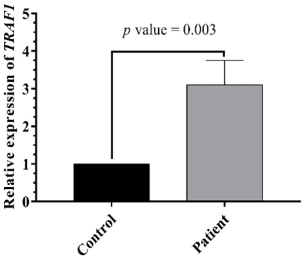 TRAF1 expression level in ALL and control. TRAF1 level varied significantly between patients and control (p = 0.0001).