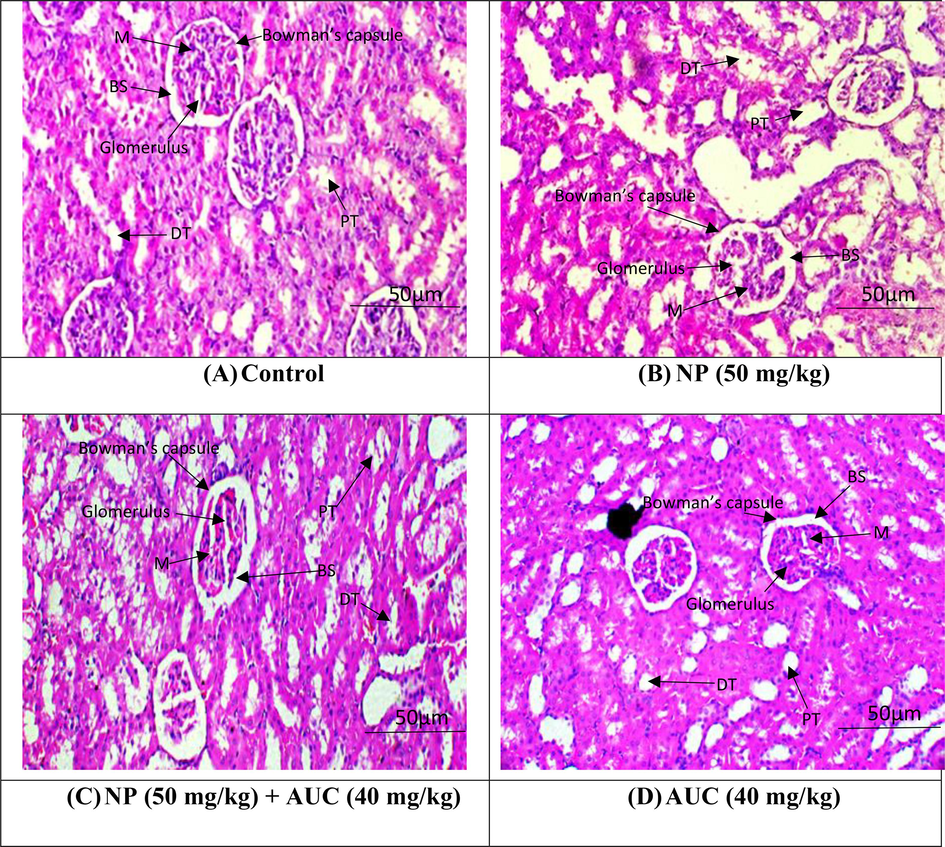 Nephroprotective effect of ACU on NP induced alterations in kidney histology. A) Control group B) NP group (50 mg/kg b.wt) C) NP (50 mg/kg b.wt) + AUC (40 mg/kg b.wt) group D) AUC group (40 mg/kg b. wt).