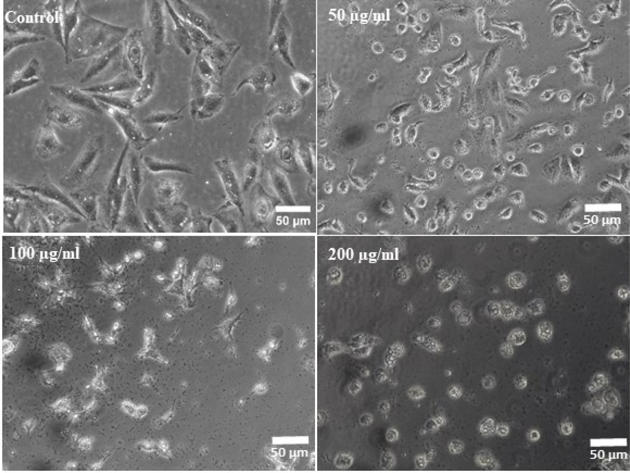 ZnFe2O4NPs-induced morphological changes in MCF-7 cells. Cells were exposed to ZnFe2O4NPs at various concentrations for 24 h. Images were taken using phase contrast inverted microscope at 20x magnifications.