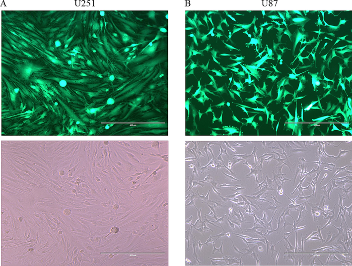 Estimation of Transduction efficiency by using GFP expression as indicator of successful transduction. A- Shows U251 transfected cells (Green). B- Shows U87 transfected cells (Green). The bottom images represent light microscope showing the same areas of the Fluorescent micrograph (A) on top (×10 magnification).