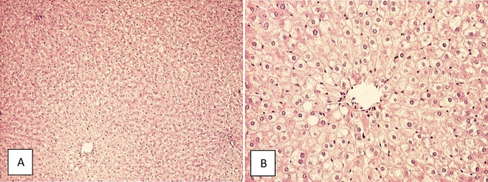 Vacuolization of hepatocyte cytoplasm in rats fed with atherogenic rodent diet for 28 days (A) HE, 40x (B) HE, 100x.