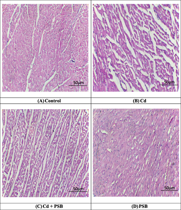 Histopathological analysis of heart tissues. H&E stain; 40X (A) Control group exhibited normal architecture of heart tissues (B) Cd exposed group demonstrated fibrosis, inflammation as well as large interstitial spaces (edema) (C) Cd + PSB group showed a remarkable recovery in contrast to Cd exposed group (D) Only PSB supplemented group showed normal morphology of cardiac tissues as in control group.