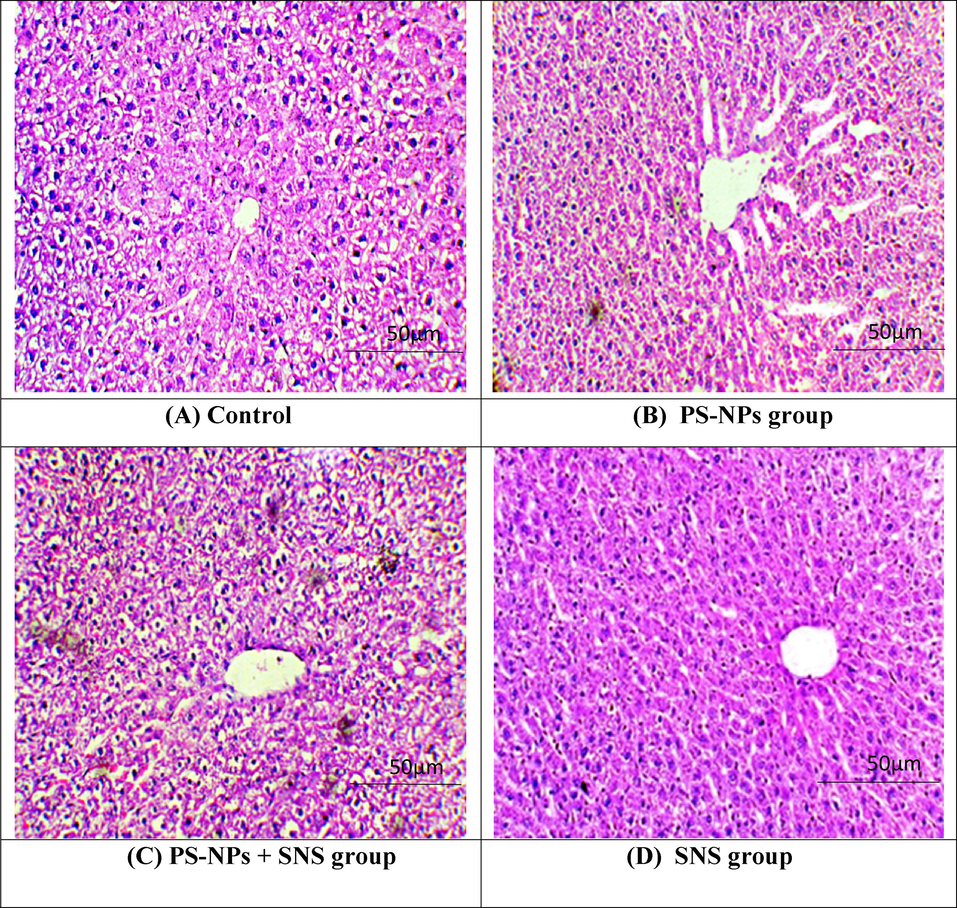 Photomicrographs of rat hepatic tissues. (A) Control group presenting normal histology. (B) PS-NPs intoxication prompted adverse alterations in liver i.e., unclear hepatocyte boundaries, congested central veins, degenerated hepatocytes, necrotic cells with nuclear dissolution and dilated sinusoid. (C) PS-NPs + SNS group displayed restored histology of liver tissues. (D) SNS group showing normal histology almost as in the control rats. PS-NPs: Polystyrene nanoplastics; SNS: Sinensetin; S: Sinusoids; CV: Central vein; KC: Kupffer cell; N: Nucleus; H: Hepatocytes.