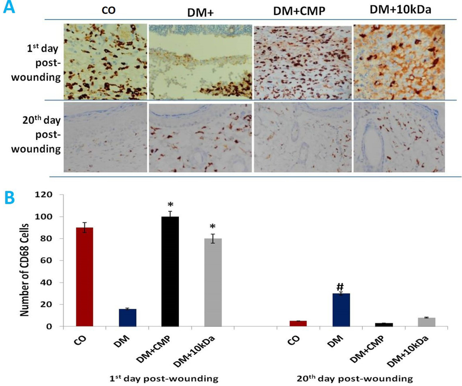 A: Skin sections stained with anti-CD68 antibodies to show macrophage activity (brown-stained cells). Wound sections (5 µm) were immune-stained with a monoclonal antibody specific for macrophages (anti-CD68 antibody) and counterstained with hematoxylin (400X). B: Histograms depict the number of cells at the beginning and twenty days after wounding. shown are means ± SD. * indicates a significant difference with the diabetic group. # indicates a significant difference with the control group.