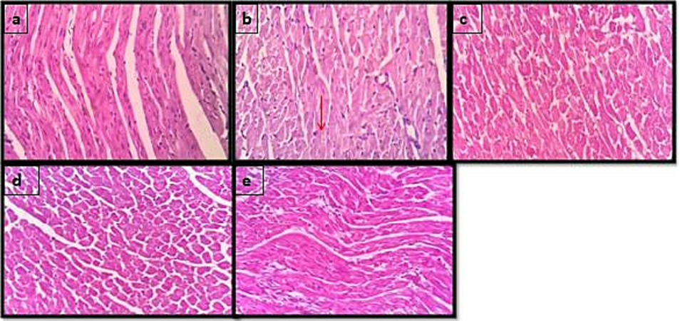 Effect of C.tomentosa on the morphology of heart in ISO-induced myocardial damage in Wistar albino rats (magnification 40×). 2(a) Normal control, 2(b) ISO 85 mg/kg, 2(c) Metaprolol 10 mg/kg, 2(d) C.tomentosa 200 mg/ and 2(e) C.tomentosa 400 mg/kg.