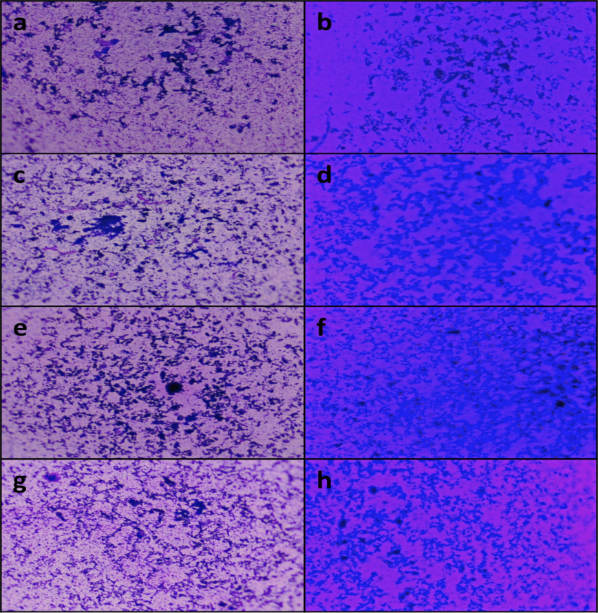 Biofilm visualization under light microscope – (a, c, e, g) control of Acinetobacter sp., E. coli, K. pneumoniae and S. aureus respectively; (b, d, f, h) treated with A. fragilissima extract.