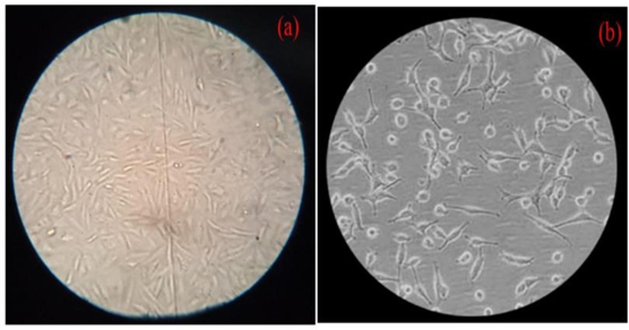 Effect of AuNPs on cancer cells' cellular shape at varying concentrations: (a) Control; (b) Maximum cells exposed at 500 µg/mL.