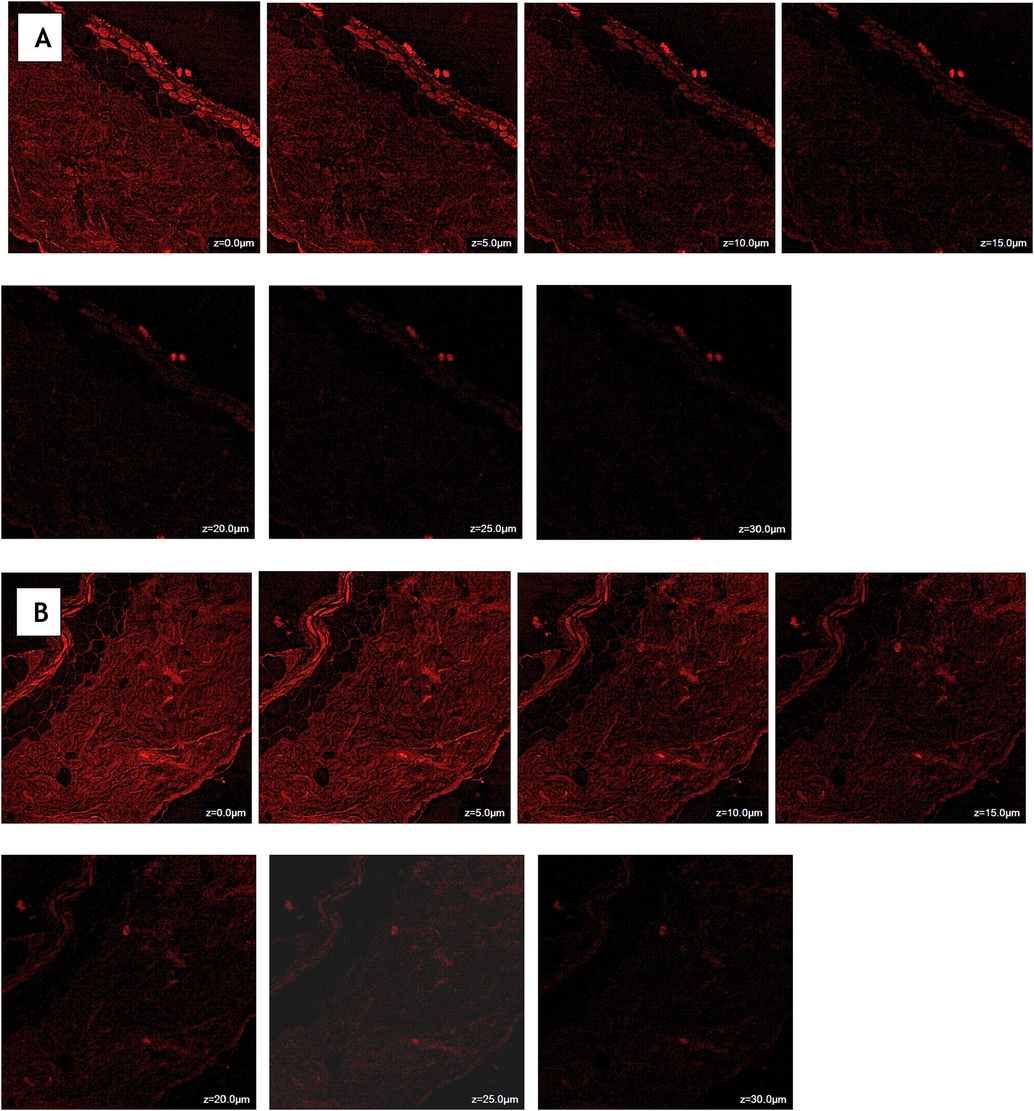 Confocal laser scanning microscopy of Rhodamine B solution (A) and Rhodamine B loaded transliposomes (B) showing a depth of penetration 15 µm and 25 µm across rat skin.