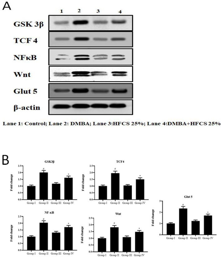 Effect of HFCS on GSK-3β, TCF-4, NF-κB, Wnt and GLUT 5 proteins modulation by western blot investigation. In Fig. 4 A: Lane 1 & Lane 3- There was no statistically significant difference between the control (Group 1) and the HFCS25% alone (Group 3) (p < 0.01). DMBA alone (Groups 2) resulted in considerably increased expression (p < 0.05) than the control (Group 1). HFCS 25 % treated hamsters (Groups 3) had considerably lower expression (p < 0.05) than DMBA alone (Group 2). In Fig. 4B. The data provided are the means and standard deviations of independent experiments.The intensity was measured with a densitometer, normalized to beta-actin expression, and expressed as a fold change with respect to the control. The data provided are the means and standard deviations of independent experiments. At p < 0.05, values that do not share a common superscript differ significantly (DMRT).