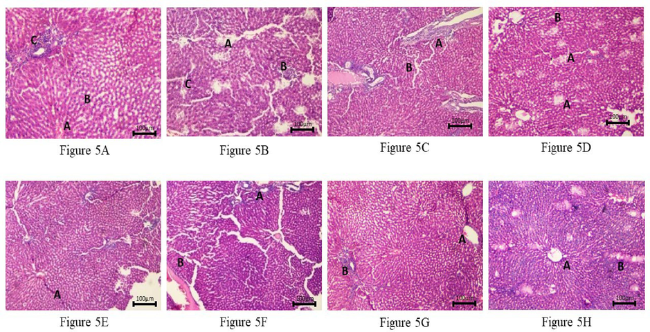 Histopathology of rat liver. (10X, H & E stain), Fig. 5 A: Photomicrograph of liver from Normal Control Group (Propylene glycol) showing normal liver microstructure central vein (A) with parallel hepatic cords (B) with normal foci of the portal triad (C). Fig. 5 B: Photomicrograph of rat liver from Negative Control Group (CCI4) showing spotty necrosis with periportal fibrosis (A) with diffuse mild acute parenchymal inflammation (B) with diffuse ballooning degeneration(C). Fig. 5 C: Photomicrograph of rat liver from Positive Control Group (Silymarin) showing mild sinusoidal dilatation with mild portal fibrosis (A) and mild lymphocytic infiltration (B). Fig. 5 D: Photomicrograph of rat liver from Test Group (CCI4 + MP Methanol 300 mg/kg) showing focal hepatocytic (A) necrosis with dilated central vein and mild lymphocytic infiltration (B) in the parenchyma. Fig. 5 E: Photomicrograph of rat liver from Test Group (CCl4 + MP Methanol 500 mg/kg) showing a decrease in necrosis of hepatocytes with irregular and thickened hepatocytes with mitosis and moderate interface hepatitis (A). Fig. 5 F: Photomicrograph of rat liver from Test Group (CCI4 + MP Ethyl acetate 300 mg/kg) showing mild periportal lymphocytic infiltrate (A) with sinusoidal congestion (B). Fig. 5 G: Photomicrograph of rat liver from Test Group (CCl4 + MP Ethyl acetate 500 mg/kg) showing mildly dilated central vein (A) with mild periportal fibrosis (B). Fig. 5 H: Photomicrograph of rat liver from Test Group (CC14 + A-450 mg/kg) showing irregular and thickened hepatocyte plate (A) with bi-nucleated forms and mild fibrosis (B) and focal chronic inflammation.