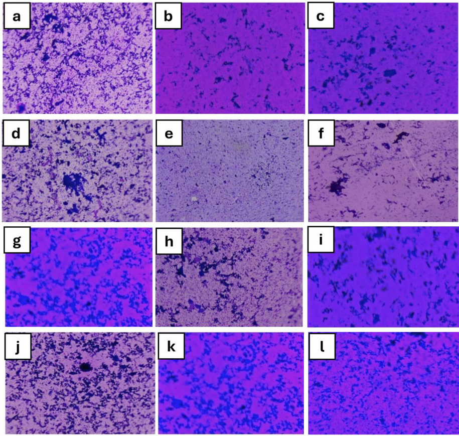 (a) Acinetobacter sp. biofilm H. dilatata (b) control (c) P. hornemannii (d) E. coli biofilm control (e) P. hornemannii (f) H. dilatata, (g) S. aureus biofilm H. dilatata (h) control (i) P. hornemannii, (j) K. pneumoniae biofilm control (k) P. hornemannii (l) H. dilatata.