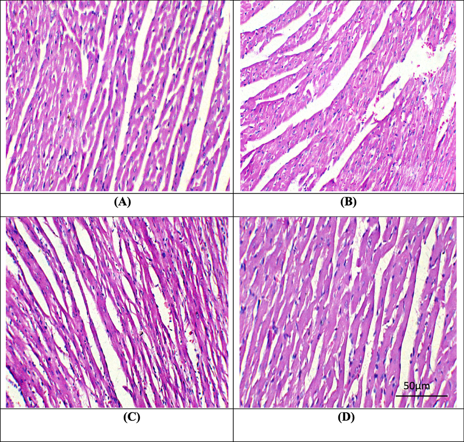 Microphotographs of cardiac tissues. A) Control group showing normal histomarphology. B) PQ administration prompted hazardous damages in cardiac tissues. C) PQ + DYD supplemented group presenting restored histomarphology of cardiac tissues. D) DYD supplemented group displaying normal histomarphology almost similar to control. PQ: Paraquat; DYD: Didymin.