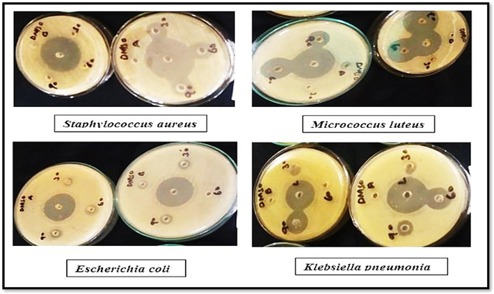 Zone of inhibition in Petri plates.