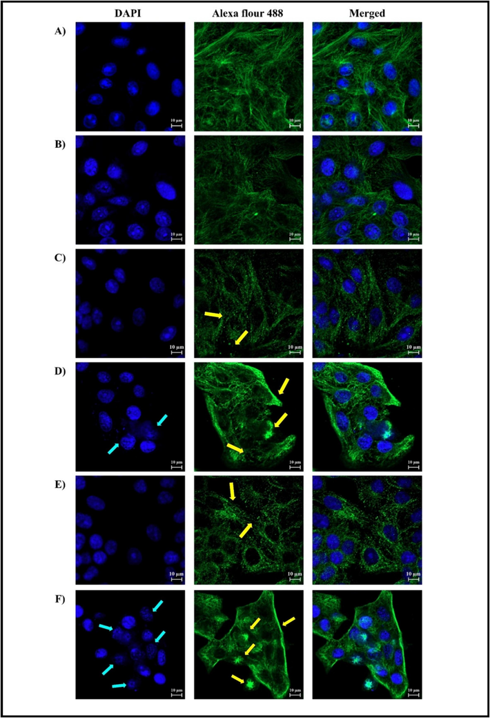 MCF-7 cells were examined by immunofluorescence confocal microscopy (scale bar is at 10 µm). A) represents control (MeoH), B) represents CQ as a positive control, C) and E) represents treatment with CQ + TubA for 24 and 48 h, respectively. The yellow arrows point to the microtubules. D) and F) represents treatment with TubA for 24 and 48 h, respectively. Blue arrows point to the nuclei, while the yellow ones point to the microtubules.