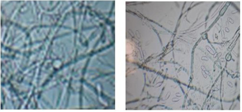 Microscopic observation of Fusarium oxysorumf.sp. lycopersici.