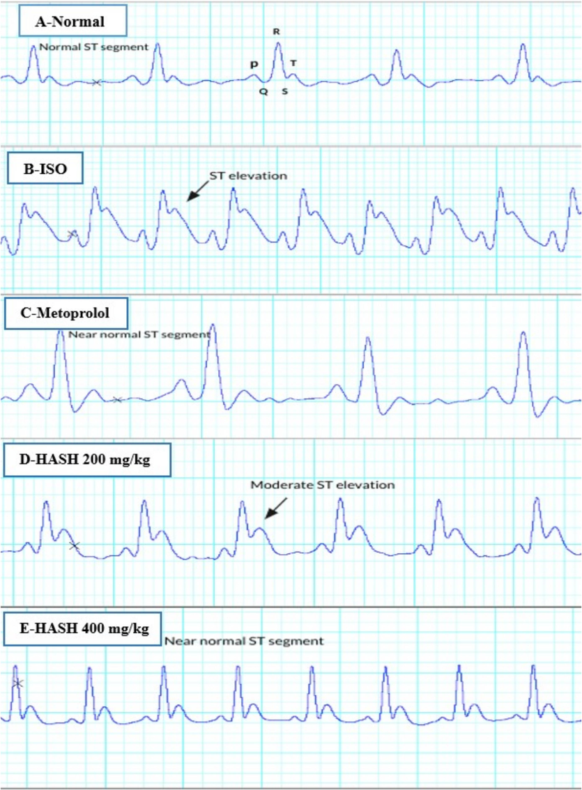 Effect of HASH on ECG tracings in rats Representative sampel of ECG from an analysis of n = 6 samples.