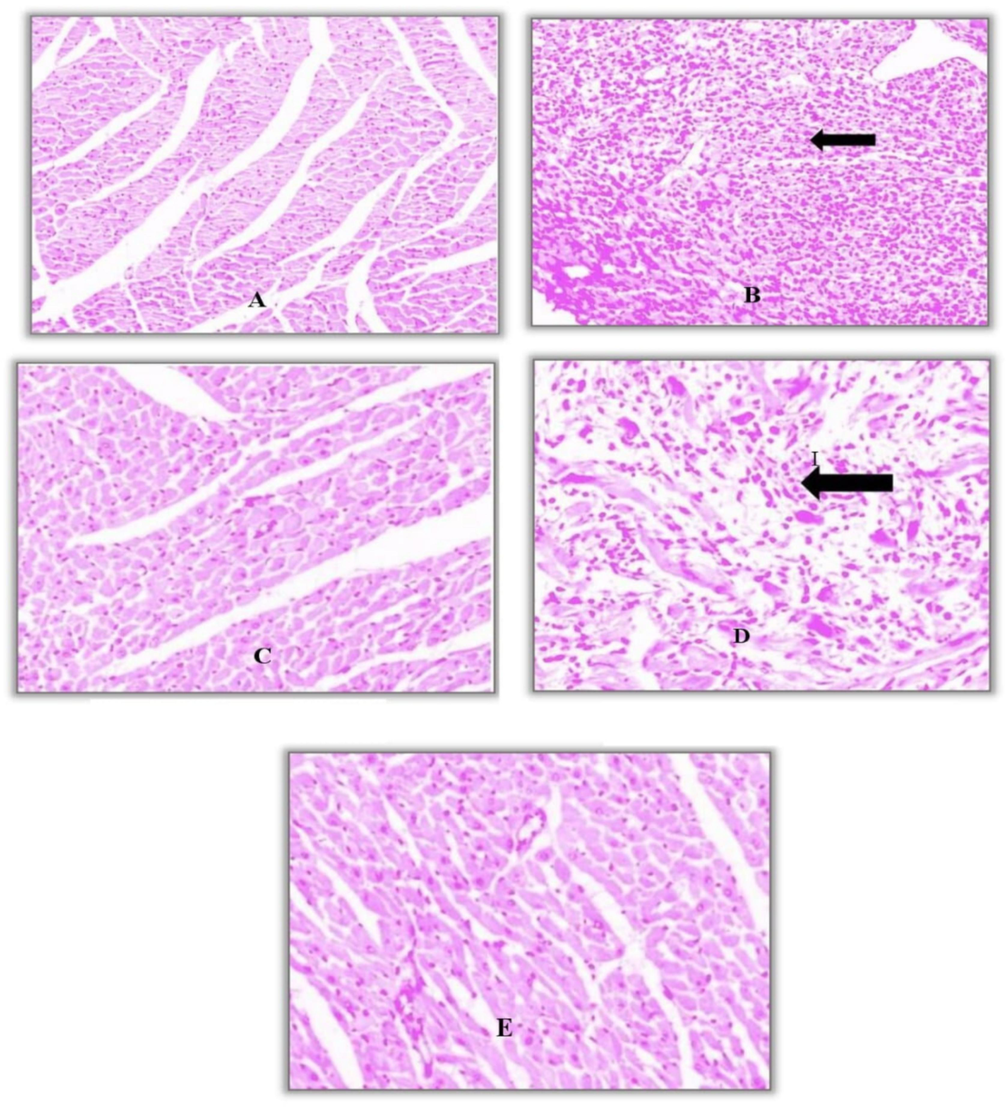 Representative images of histological examinations of different treatments (n = 6). Normal control; B) MI control group; C) Metoprolol (10 mg/kg); D) HASH-LD (200 mg/kg); E) HASH-HD (400 mg/kg).