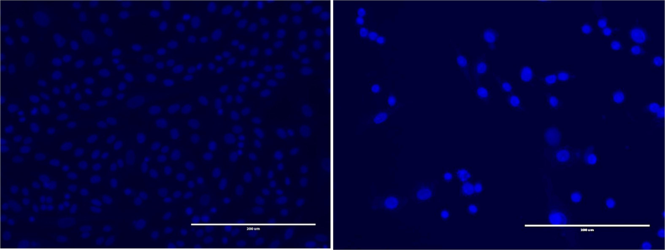 Fluorescent photomicrographs depict the HepG2 cancer cell line stained with DAPI after exposure to the F2 extract (300 μg/mL). The panels illustrate the following: (A) Untreated HepG2 cell line, (B) Treated HepG2 cell line after 24 h of incubation.