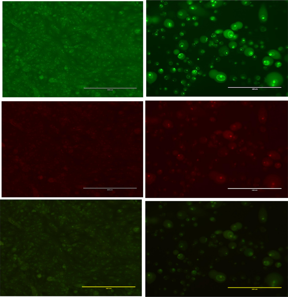 Acridine orange/ethidium bromide staining of HepG2 cells to detect apoptosis induced by F2 extract from C. plumbagineus (300 µg/mL). (A) negative control (B) treated cells. Live cells are uniformly green (L). In contrast, apoptotic cells (AP) are characterised by green and fragmented chromatin.