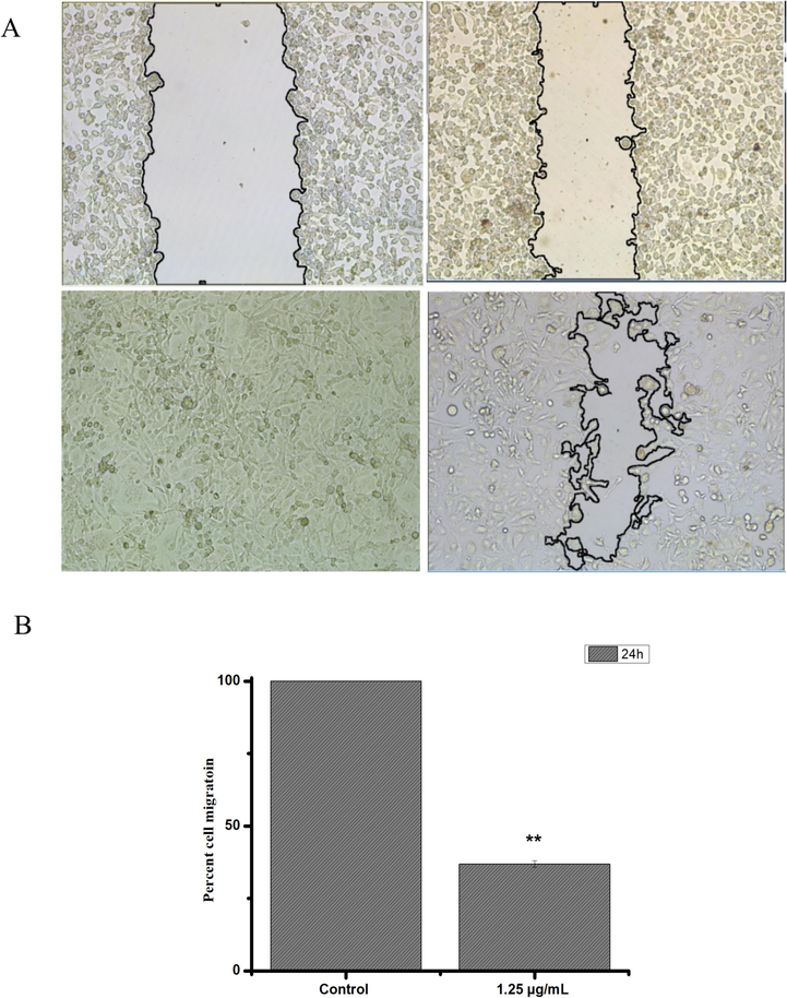 The effects of the F2 extract from C. plumbagineus on the migration of HepG2 cells were evaluated. Figure A displays images of the wound monolayer of HepG2 cells at two points: immediately after wounding (t = 0 h) and after a 24-hour incubation period. Cells were either left untreated (control) or treated with the extract at 87.5 µg/mL. Figure B illustrates the calculated cell migration rate using the methodology described in the materials and methods section. The experiments were performed in triplicate, and statistical analysis was conducted using Student's t-test (*p < 0.05 vs control).