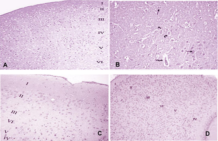 Photomicrographs of cerebral cortex sections prepared for all the four treatment groups. (A) G1 (control): the cerebral cortex is labeled as follows: molecular layer (I), outer granular layer (II), outer pyramidal layer (III), inner granular layer (IV), inner pyramidal layer (V), and polymorphic layer (VI). (B) G2 (GNPs): disorganization of the normal architecture – most pyramidal cells are distorted with darkly stained nuclei (arrow); some cells are surrounded by clear pericellular halos (curved arrow), and vascular dilatation occurred in the neuropil (zigzag arrow). (C) G3 (SFN): normal histological appearance. (D) G4 (SFN + GNPs): normal histological appearance of the cerebral cortex, (H&E 20).