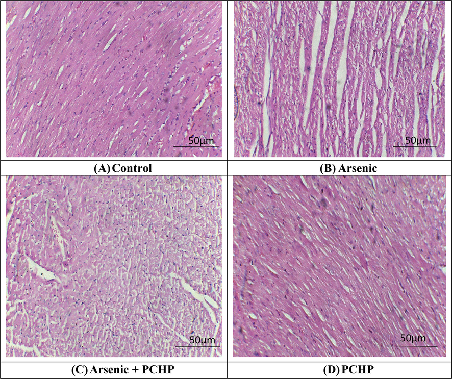 Histopathological analysis of heart tissues. H&E stain; 40X (A) Control group exhibited normal architecture of heart tissues (B) Arsenic exposed group demonstrated fibrosis, inflammation as well as large interstitial spaces (edema) (C) Arsenic + PCHP group showed a remarkable recovery in contrast to Arsenic exposed group (D) Only PCHP supplemented group showed normal morphology of cardiac tissues as in control group.