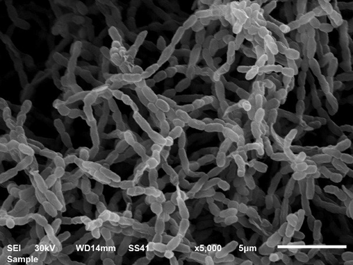 Scanning electron micrograph showing the morphological characteristics of Streptomyces isolate S295.