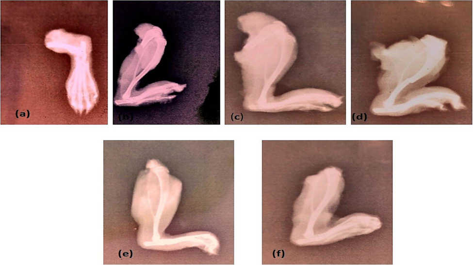 X-ray evaluation showed significant improvement in CFA-induced arthritic hind paws by methanolic aerial extract of Strelitizia reginae especially at 600 mg/kg dose. Here, (a) shows (NC), (b) represents (AC), (c) exhibited piroxicam-treated, (d) 150 mg/kg (e) 300 mg/kg and (f) 600 mg/kg represents effects of different doses.