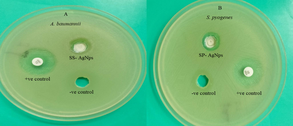 Observations of antibacterial activity, (A) Ss-AgNPs against A. baumannii, (B) Ssp-AgNPs against S. pyogenes.