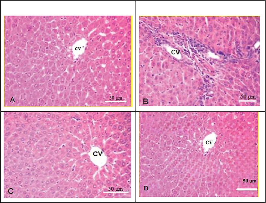 Photomicrograph of liver section from all studied rat groups. (A) control rat group show normal liver architecture;(B) Malathion treated group showed infiltration of inflammatory cells; (C) M+WGO-malathion, and wheat germ oil group, showing a reduction in histological abnormalities and reduced amounts of inflammatory cells, (D)WGO group, show normal liver architecture. CV stands for central vein.