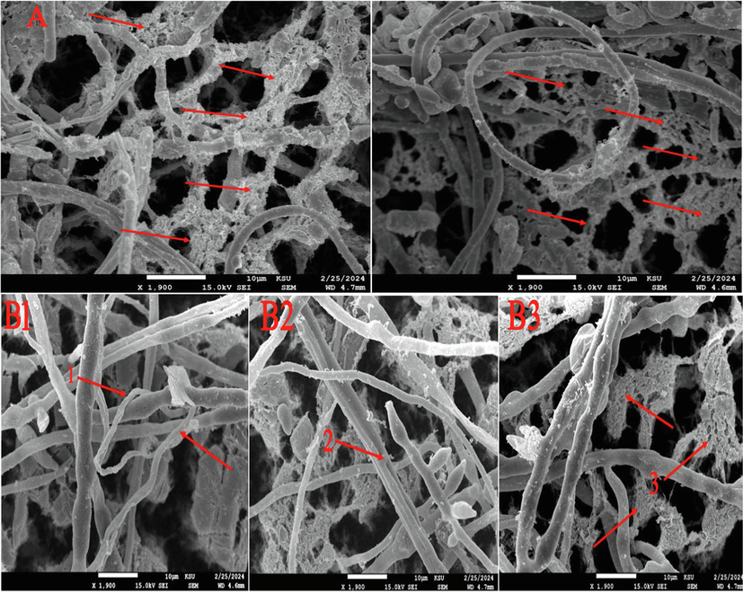 A- Lysis of F.p mycelium owing to the action of biocontrol agent metabolites, B- mycoparasitic behavior of D. caatingaensis against F.o.S3 (B1: coiling of D. caatingaensis around fungal phytopathogens, B2: formation of appressorium, B3: lysis of mycelium).