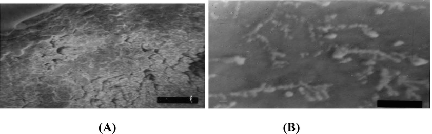 Scanning Electron Microscope (A) Biofilm formation of PAO1 Δpsl before treatment with β-sitosterol (B) Biofilm of PAO1 Δpsl after treatment with β-sitosterol showing disruption of biofilm.