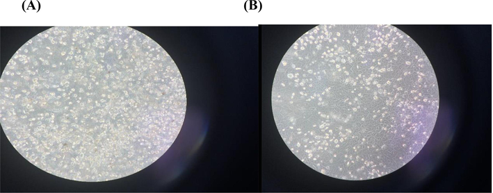 (A) showed MDCK under microscope at 0-time control condition, fig (B) showed 72 h. incubation with β-sitosterol.