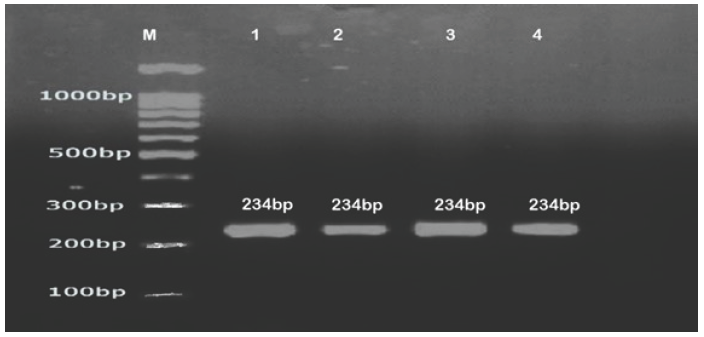 DNA ladder 100bp (Transgen Biotech), C. parapsilosis (1,2,3,4).