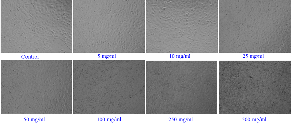 γ-Al2O3NPs - induced morphological changes in Caco-2 cells. Cells were exposed to Al2O3-NPs at various concentrations for 24 hrs. Images were taken using a phase contrast inverted microscope at 20x magnification.